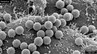 Hantavirus
