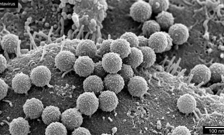 Hantavirus