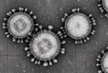 Hantavirus