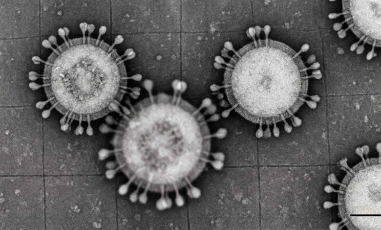 Hantavirus