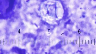 ciclosporiasis