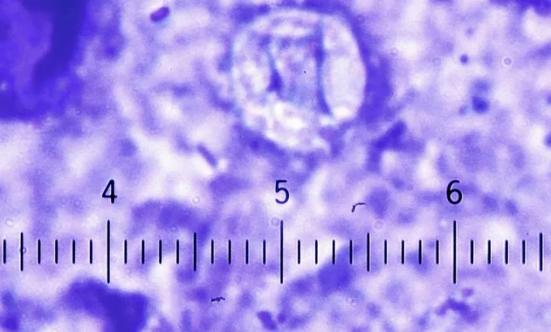 ciclosporiasis